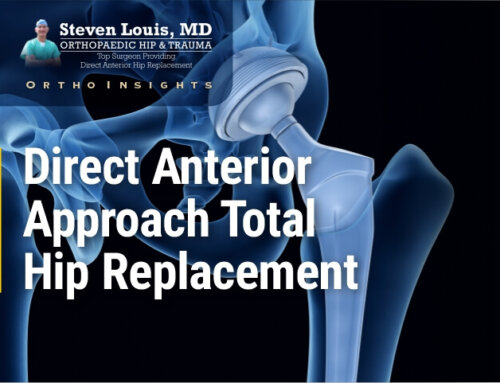 Direct Anterior Hip Replacement
