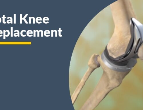 Home Exercises After Knee Replacement