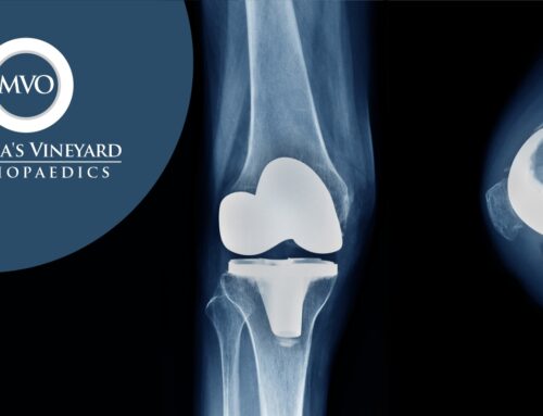 How To Decide About Surgery For Your Hip & Knee Problems